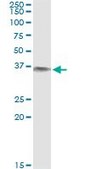 Monoclonal Anti-BLVRA antibody produced in mouse clone S2, purified immunoglobulin, buffered aqueous solution