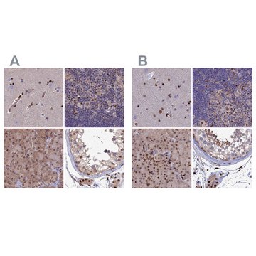 Anti-DNPEP antibody produced in rabbit Prestige Antibodies&#174; Powered by Atlas Antibodies, affinity isolated antibody, buffered aqueous glycerol solution