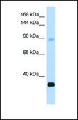 Anti-BCL11B antibody produced in rabbit affinity isolated antibody
