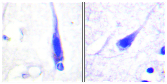 Anti-Calmodulin antibody produced in rabbit affinity isolated antibody