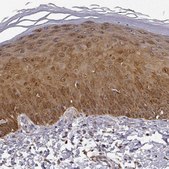 Anti-PHGDH antibody produced in rabbit Prestige Antibodies&#174; Powered by Atlas Antibodies, affinity isolated antibody, buffered aqueous glycerol solution, Ab1