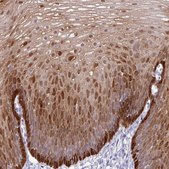 Anti-ALDH3A1 antibody produced in rabbit Prestige Antibodies&#174; Powered by Atlas Antibodies, affinity isolated antibody, buffered aqueous glycerol solution