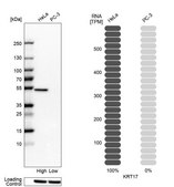 Anti-KRT17 antibody produced in rabbit Prestige Antibodies&#174; Powered by Atlas Antibodies, affinity isolated antibody, buffered aqueous glycerol solution