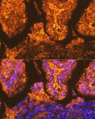 Anti-FABPI antibody produced in rabbit