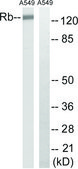 Anti-Retinoblastoma antibody produced in rabbit affinity isolated antibody