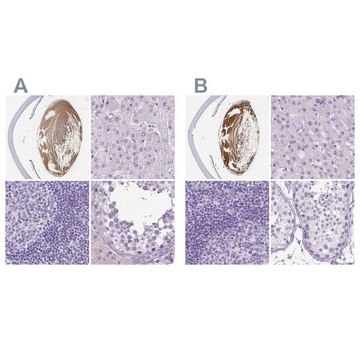 Anti-LGSN antibody produced in rabbit Prestige Antibodies&#174; Powered by Atlas Antibodies, affinity isolated antibody, buffered aqueous glycerol solution