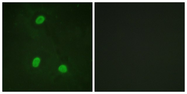 Anti-NIPA antibody produced in rabbit affinity isolated antibody
