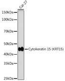 Anti-Cytokeratin 15 (KRT15) Antibody, clone 9F9F0, Rabbit Monoclonal