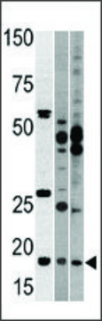 Anti-NCBP2 (N-term) antibody produced in rabbit IgG fraction of antiserum, buffered aqueous solution