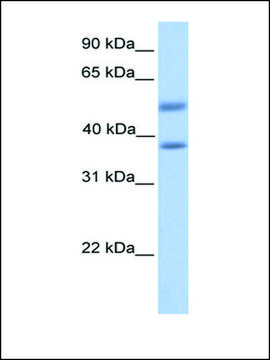 Anti-ST6GALNAC2 antibody produced in rabbit affinity isolated antibody