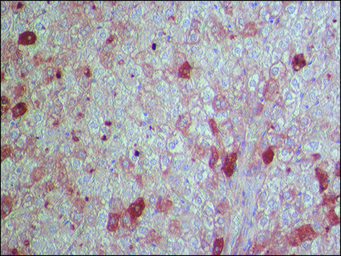 Anti-Glycogen Synthase 2 antibody produced in rabbit ~1.0&#160;mg/mL, affinity isolated antibody