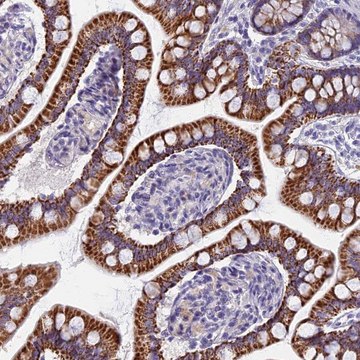 Anti-AP4E1 antibody produced in rabbit Prestige Antibodies&#174; Powered by Atlas Antibodies, affinity isolated antibody, buffered aqueous glycerol solution