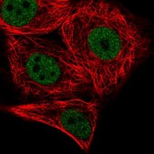 Anti-PATZ1 antibody produced in rabbit Prestige Antibodies&#174; Powered by Atlas Antibodies, affinity isolated antibody, buffered aqueous glycerol solution