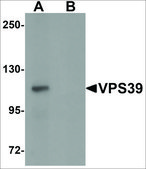 Anti-VPS39 antibody produced in rabbit affinity isolated antibody