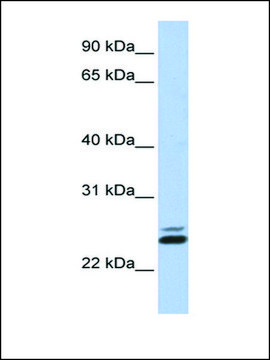 Anti-JAZF1 (AB1) antibody produced in rabbit affinity isolated antibody