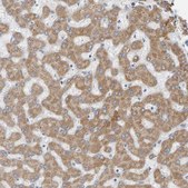 Anti-ADHFE1 antibody produced in rabbit Prestige Antibodies&#174; Powered by Atlas Antibodies, affinity isolated antibody, buffered aqueous glycerol solution