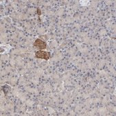 Anti-RAB5C antibody produced in rabbit Prestige Antibodies&#174; Powered by Atlas Antibodies, affinity isolated antibody, buffered aqueous glycerol solution