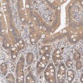 Anti-CHKA antibody produced in rabbit Prestige Antibodies&#174; Powered by Atlas Antibodies, affinity isolated antibody, buffered aqueous glycerol solution