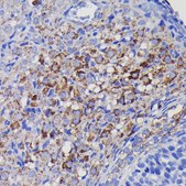 Anti-SOD2 antibody produced in rabbit