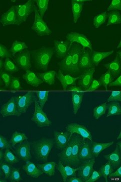 Anti- PRMT6 antibody produced in rabbit