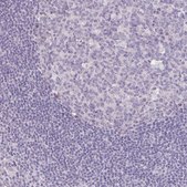 Anti-KIAA1210 antibody produced in rabbit Prestige Antibodies&#174; Powered by Atlas Antibodies, affinity isolated antibody, buffered aqueous glycerol solution