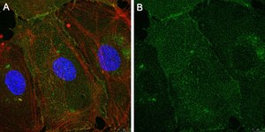 Anti-Integrin &#945;V&#946;3 Antibody, clone LM609 ZooMAb&#174; Mouse Monoclonal recombinant, expressed in HEK 293 cells