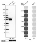 Anti-VIM antibody produced in rabbit Prestige Antibodies&#174; Powered by Atlas Antibodies, affinity isolated antibody, buffered aqueous glycerol solution