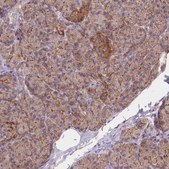Anti-AK3 antibody produced in rabbit Prestige Antibodies&#174; Powered by Atlas Antibodies, affinity isolated antibody, buffered aqueous glycerol solution