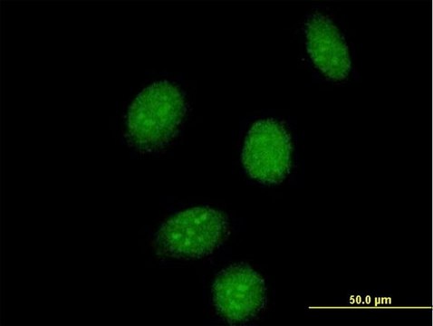 Anti-SSBP2 antibody produced in mouse purified immunoglobulin, buffered aqueous solution