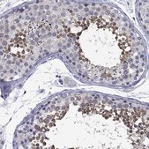 Anti-BCL2L14 antibody produced in rabbit Prestige Antibodies&#174; Powered by Atlas Antibodies, affinity isolated antibody, buffered aqueous glycerol solution