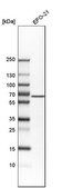 Anti-ACVRL1 antibody produced in rabbit Prestige Antibodies&#174; Powered by Atlas Antibodies, affinity isolated antibody, buffered aqueous glycerol solution