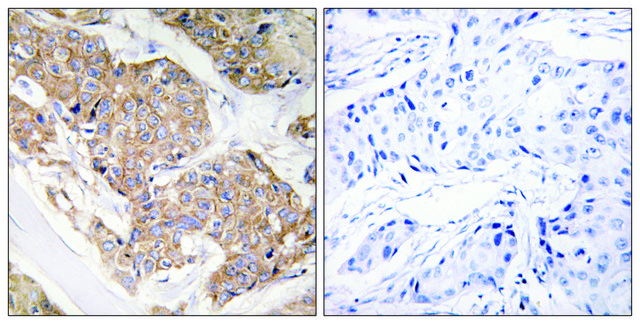 Anti-IL-13R antibody produced in rabbit affinity isolated antibody