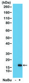 Anti-Acetyl-Histone H3 (Lys36) antibody, Rabbit monoclonal recombinant, expressed in HEK 293 cells, clone RM154, purified immunoglobulin