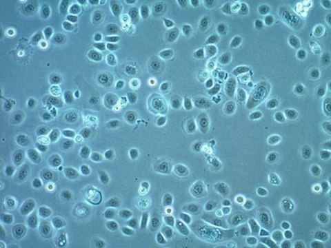 A2EN Human Endocervical Epithelial Cell Line A2EN endocervical epithelial cell line can be used to study sexually transmitted pathogen infections, pathogenesis and the innate immune response.