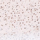 Monoclonal Anti-FOXP2 antibody produced in mouse Prestige Antibodies&#174; Powered by Atlas Antibodies, clone CL5312, purified immunoglobulin, buffered aqueous glycerol solution