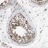 Anti-SLC25A20 antibody produced in rabbit Prestige Antibodies&#174; Powered by Atlas Antibodies, affinity isolated antibody, buffered aqueous glycerol solution
