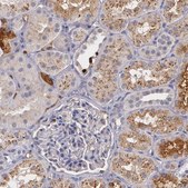Anti-PTS antibody produced in rabbit Prestige Antibodies&#174; Powered by Atlas Antibodies, affinity isolated antibody, buffered aqueous glycerol solution