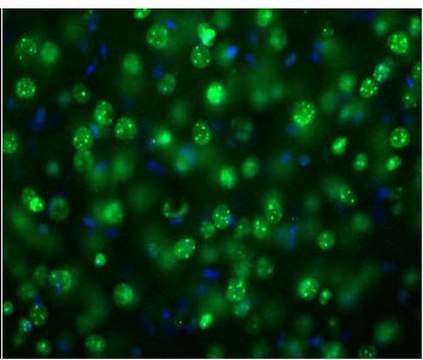 Anti-MeCP2 from rabbit, purified by affinity chromatography