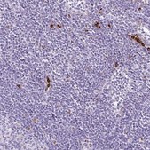 Anti-LYZ antibody produced in rabbit Prestige Antibodies&#174; Powered by Atlas Antibodies, affinity isolated antibody, buffered aqueous glycerol solution