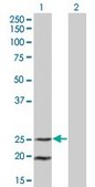 Monoclonal Anti-IL6, (C-terminal) antibody produced in mouse clone 3F4, purified immunoglobulin, buffered aqueous solution