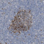 Anti-UBAP2 antibody produced in rabbit Prestige Antibodies&#174; Powered by Atlas Antibodies, affinity isolated antibody, buffered aqueous glycerol solution