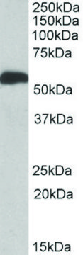 Anti-ALDH5A1 antibody produced in goat affinity isolated antibody, buffered aqueous solution