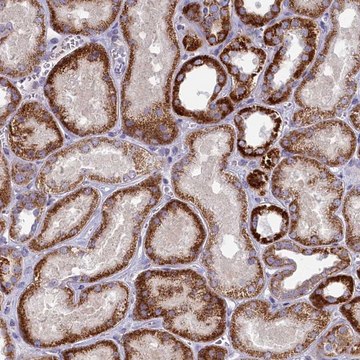 Anti-FAM196A antibody produced in rabbit Prestige Antibodies&#174; Powered by Atlas Antibodies, affinity isolated antibody, buffered aqueous glycerol solution