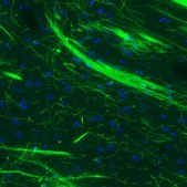 Monoclonal Anti-MBP antibody produced in mouse Prestige Antibodies&#174; Powered by Atlas Antibodies, clone CL2827, purified immunoglobulin, buffered aqueous glycerol solution