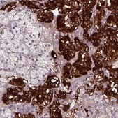 Anti-DBH antibody produced in rabbit Prestige Antibodies&#174; Powered by Atlas Antibodies, affinity isolated antibody