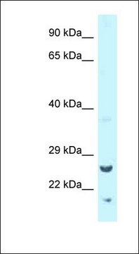 Anti-TK1 antibody produced in rabbit affinity isolated antibody