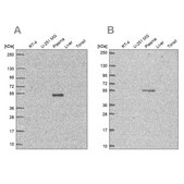 Anti-EED antibody produced in rabbit Prestige Antibodies&#174; Powered by Atlas Antibodies, affinity isolated antibody, buffered aqueous glycerol solution