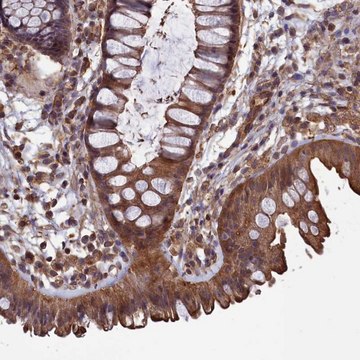 Anti-DAPK3 antibody produced in rabbit Prestige Antibodies&#174; Powered by Atlas Antibodies, affinity isolated antibody, buffered aqueous glycerol solution