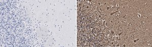 Anti-Aldolase C Antibody, clone 3B18, ZooMAb&#174; Rabbit Monoclonal recombinant, expressed in HEK 293 cells