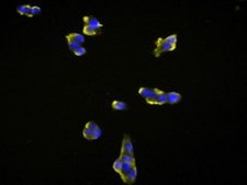 INS-1E Rat Insulinoma Beta Cell Line